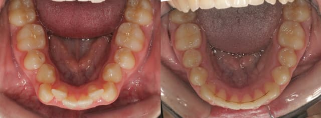 Arpino Orthodontics photo