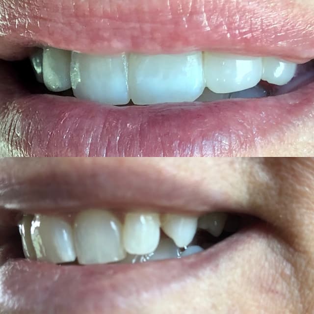 Smile Solutions of CNY photo