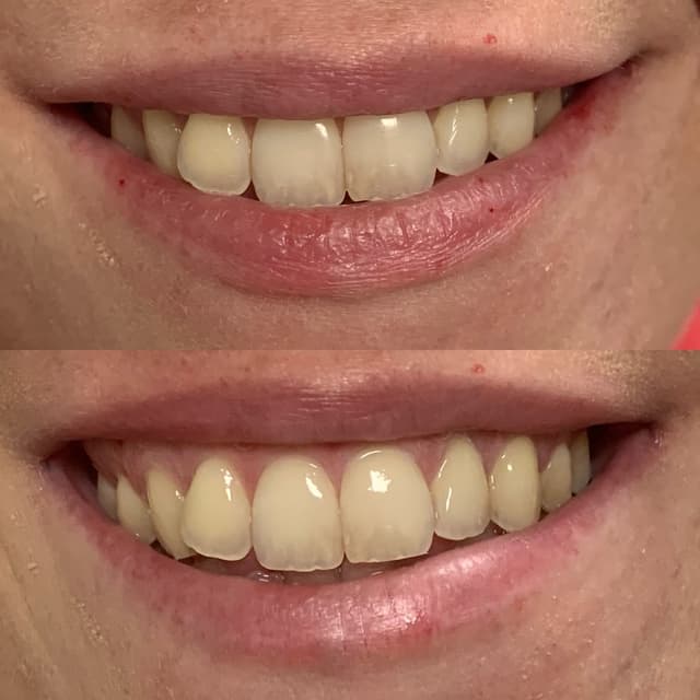 Smile Solutions of CNY photo