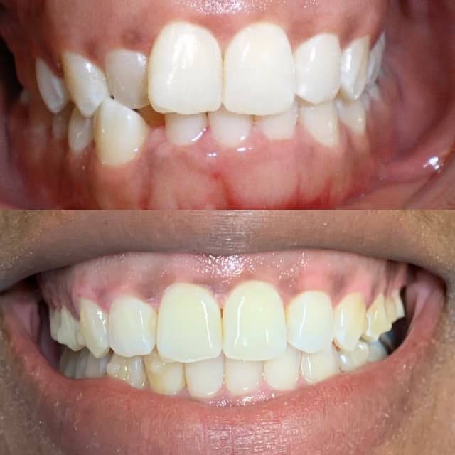 Smile Solutions of CNY photo