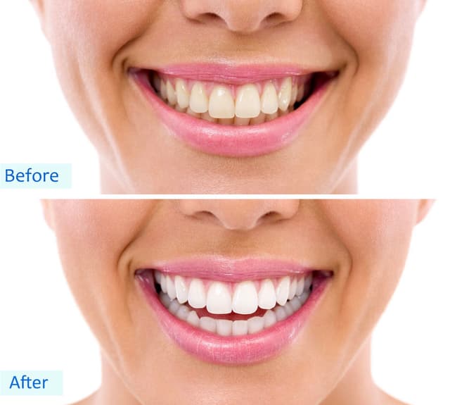 Smile Solutions of CNY photo