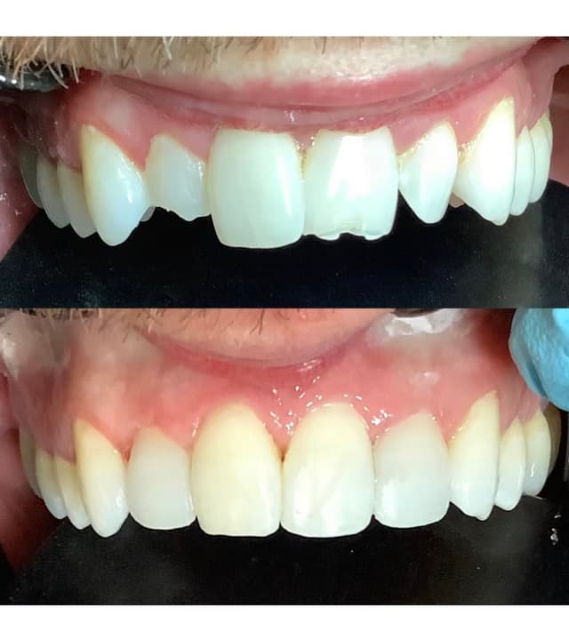 Smile Solutions of CNY photo