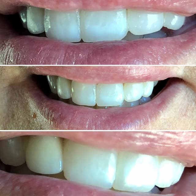 Smile Solutions of CNY photo