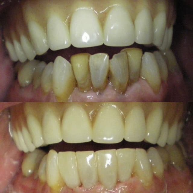 Smile Solutions of CNY photo