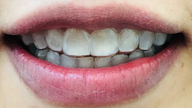 Care Orthodontics photo