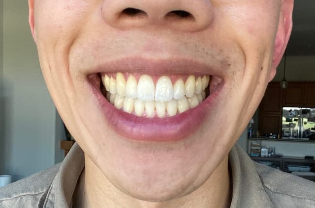 Care Orthodontics photo