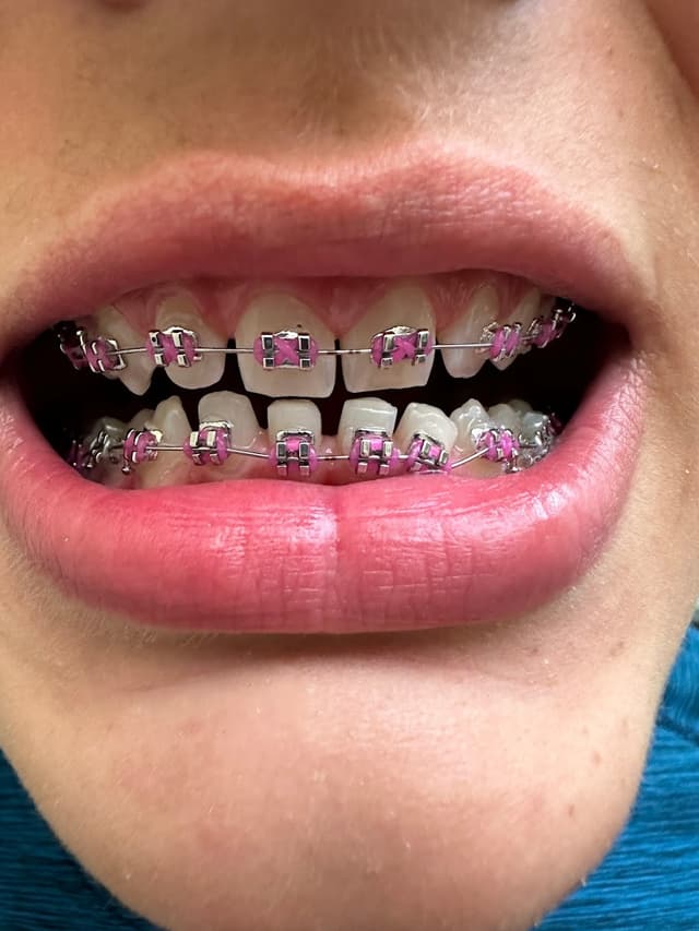 Speaker Orthodontics photo