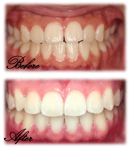 Lemke Orthodontics photo