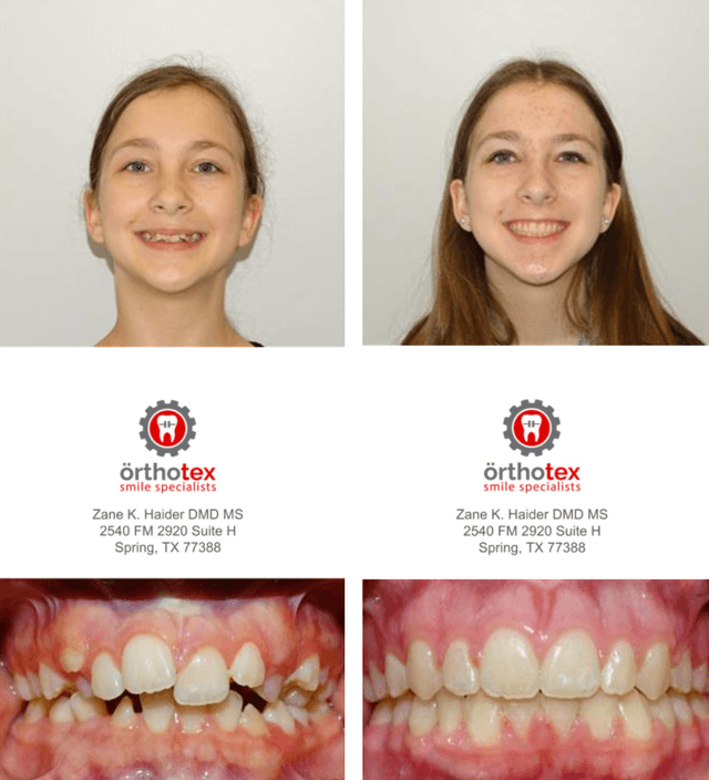 Orthotex Smile Specialists photo