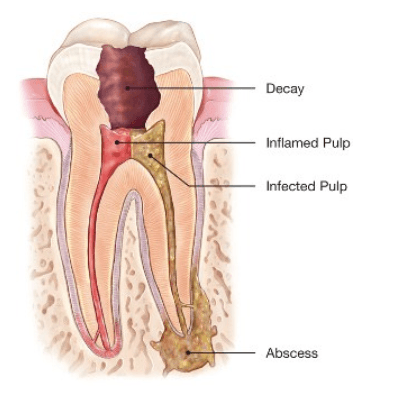 Silicon Valley Endodontics and Microsurgery photo