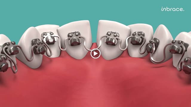Oviedo Orthodontics photo