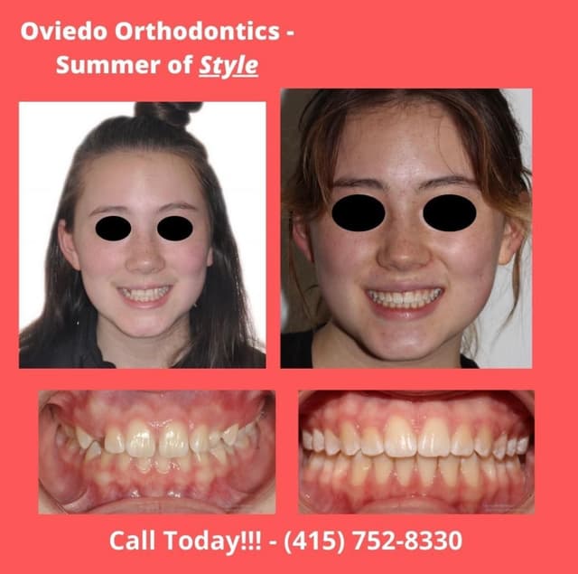 Oviedo Orthodontics photo
