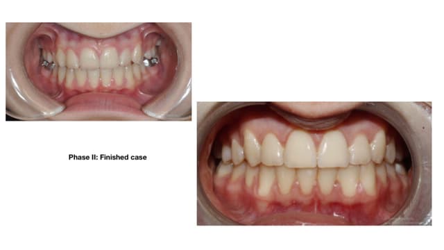 Oviedo Orthodontics photo