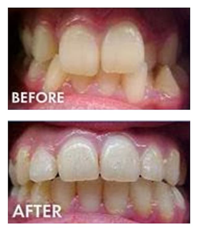 Cool Smiles Orthodontics - Corona photo