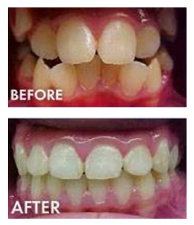 Cool Smiles Orthodontics - Perris photo