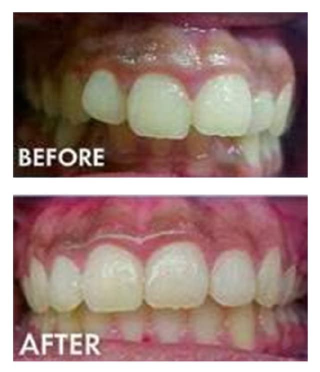Cool Smiles Orthodontics - Perris photo