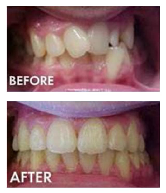 Cool Smiles Orthodontics - Perris photo