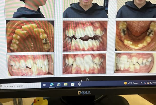 Braces by Garcia photo