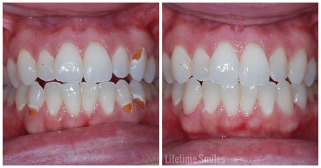 Lifetime Smiles photo