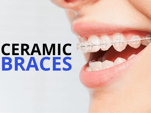 Lafayette Orthodontics photo