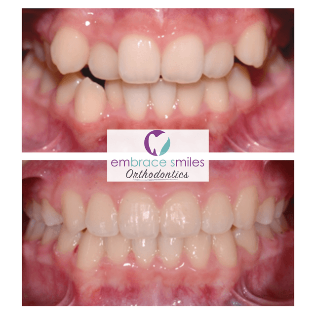 Embrace Smiles Orthodontics photo
