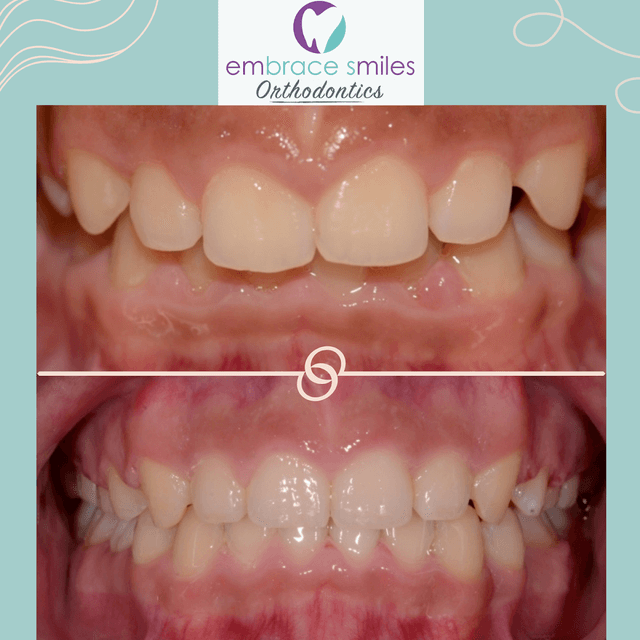 Embrace Smiles Orthodontics photo