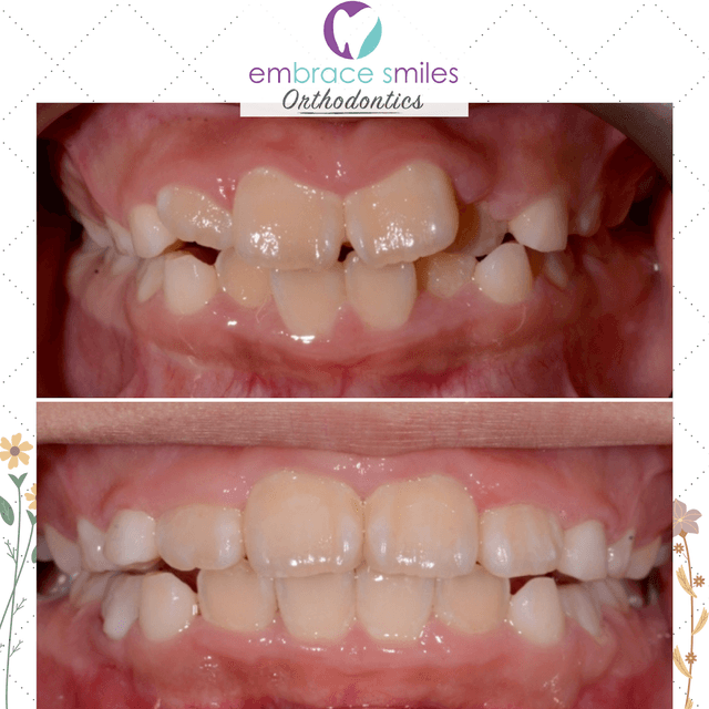 Embrace Smiles Orthodontics photo