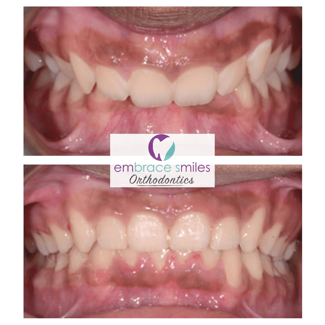 Embrace Smiles Orthodontics photo