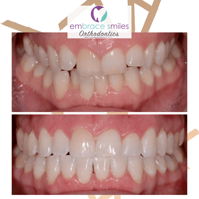 Embrace Smiles Orthodontics photo