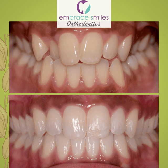 Embrace Smiles Orthodontics photo