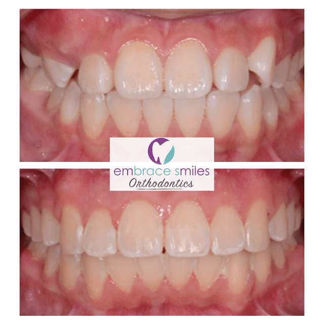Embrace Smiles Orthodontics photo