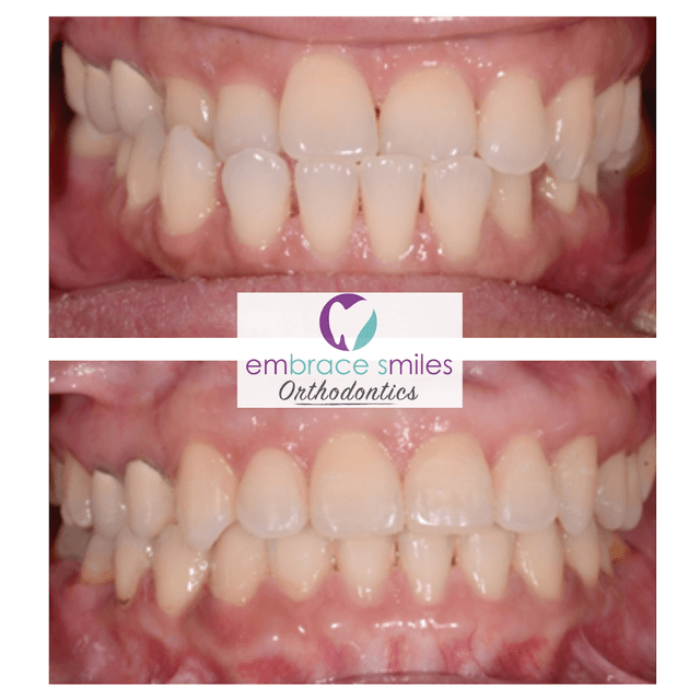 Embrace Smiles Orthodontics photo