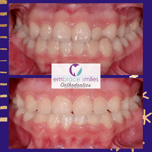 Embrace Smiles Orthodontics photo