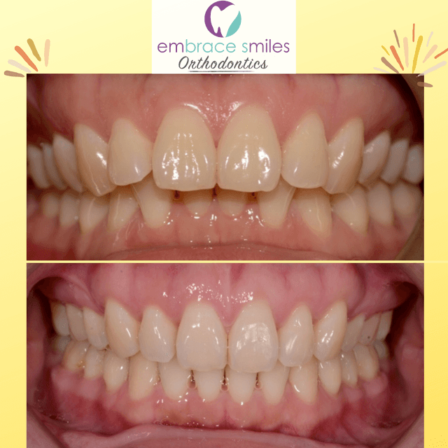 Embrace Smiles Orthodontics photo