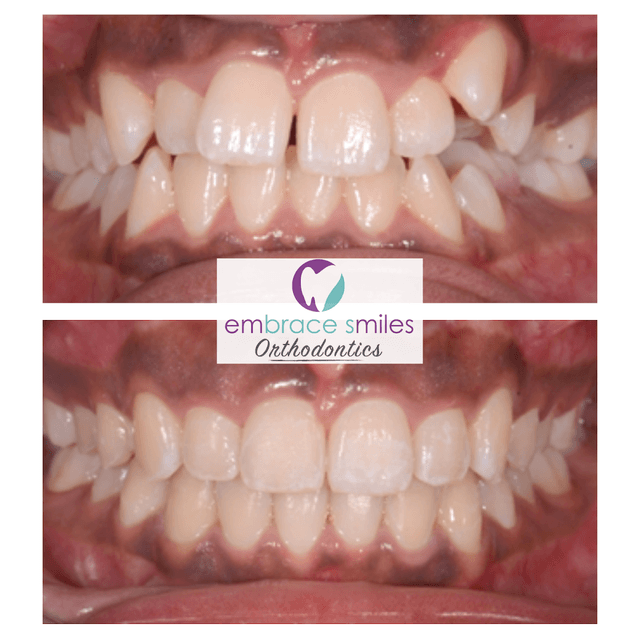 Embrace Smiles Orthodontics photo