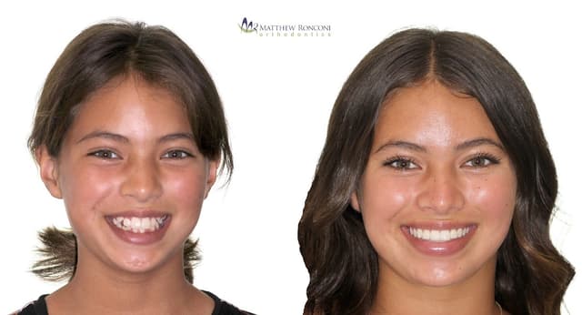 Matthew Ronconi Orthodontics photo