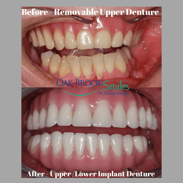 Oak Brook Smiles photo