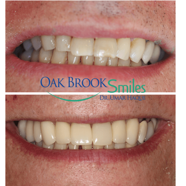 Oak Brook Smiles photo
