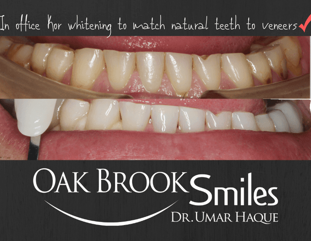 Oak Brook Smiles photo