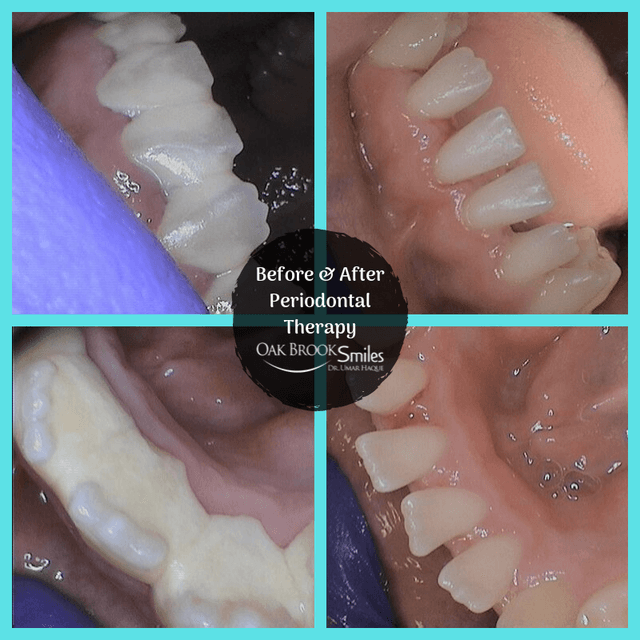 Oak Brook Smiles photo