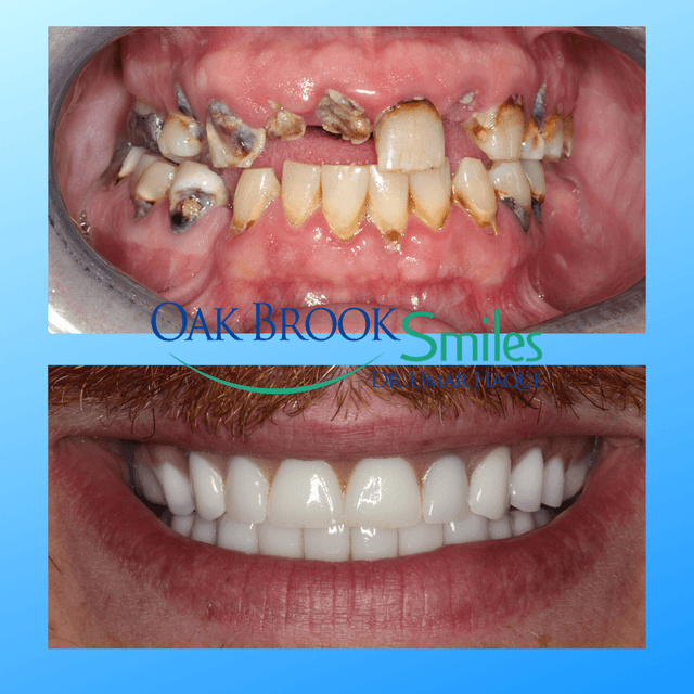 Oak Brook Smiles photo