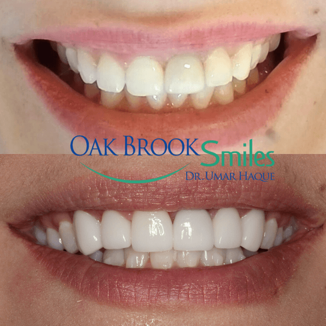 Oak Brook Smiles photo