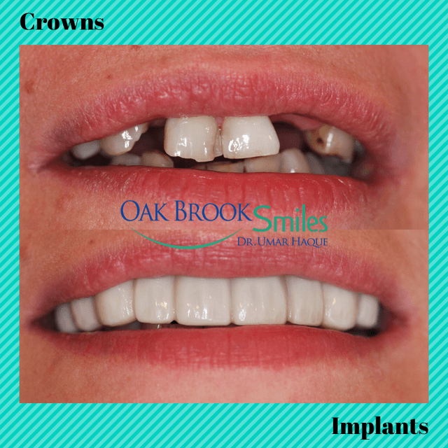 Oak Brook Smiles photo