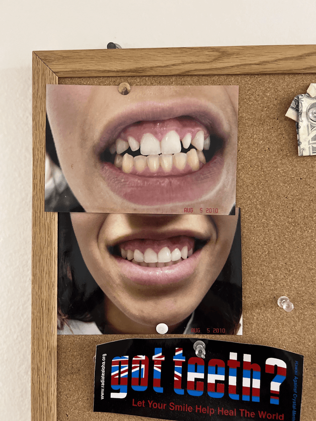 Manteca Smiles photo