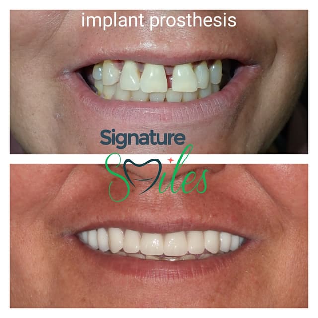 Signature Smiles of Plano photo
