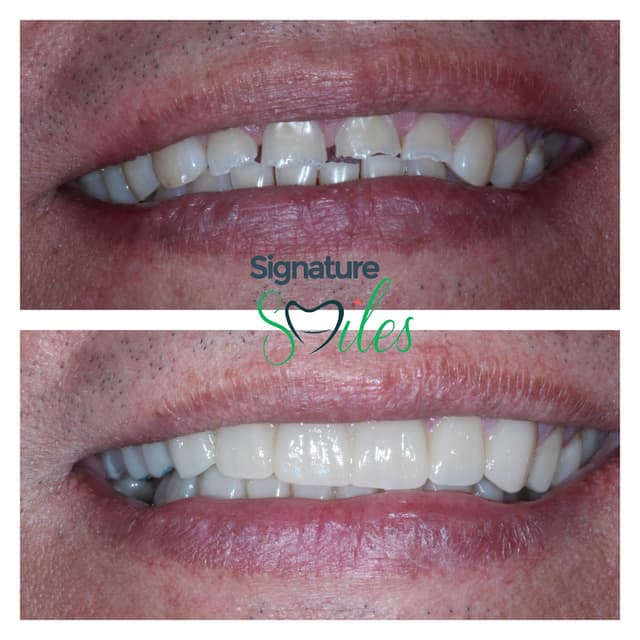 Signature Smiles of Plano photo