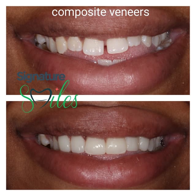 Signature Smiles of Plano photo