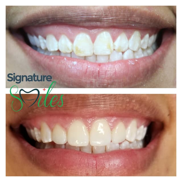 Signature Smiles of Plano photo
