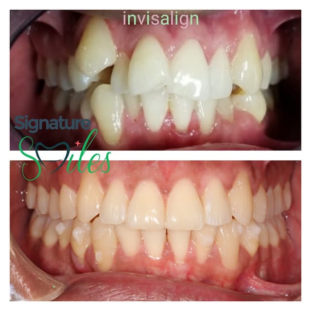 Signature Smiles of Irving photo