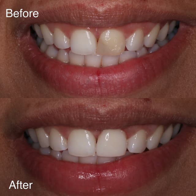 Professional Smiles photo